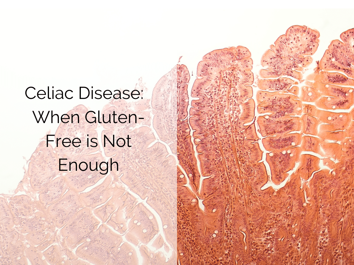 Celiac Disease When Gluten-Free is Not Enough